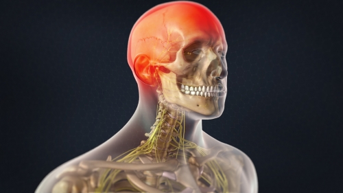 First Aid for an Occipital Nerve Block